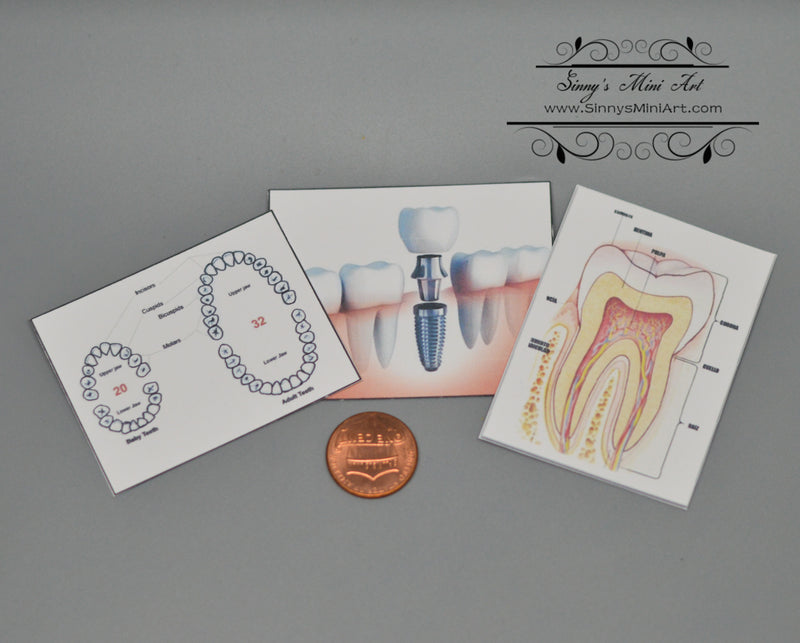 1:12 Dollhouse Miniature Dental Surgery Three assorted Dental Posters SMA HM002-1